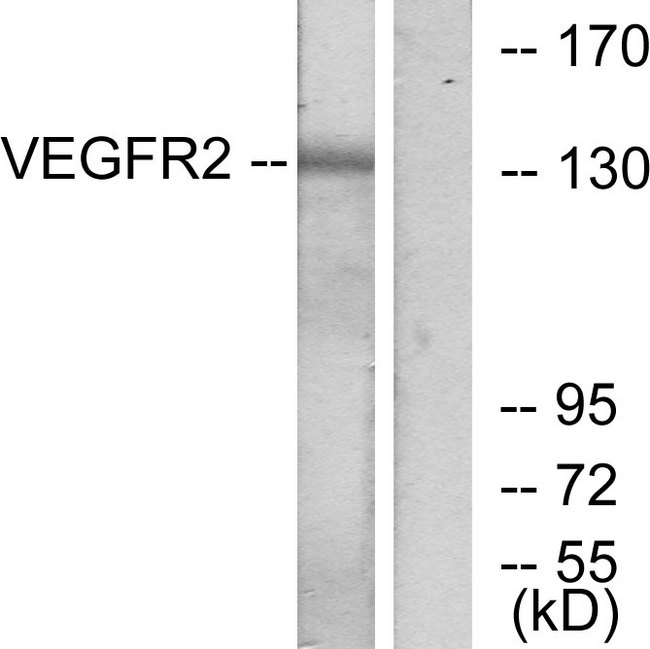 KDR / VEGFR2 / FLK1 Antibody - Western blot analysis of lysates from K562 cells, treated with LPS 100ng/ml 30', using VEGFR2 Antibody. The lane on the right is blocked with the synthesized peptide.