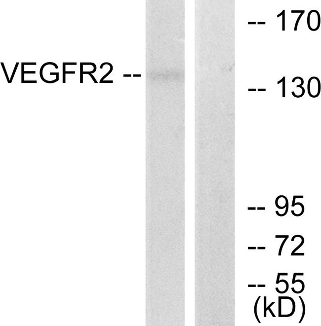 KDR / VEGFR2 / FLK1 Antibody - Western blot analysis of lysates from 293 cells, treated with LPS 100ng/ml 30', using VEGFR2 Antibody. The lane on the right is blocked with the synthesized peptide.