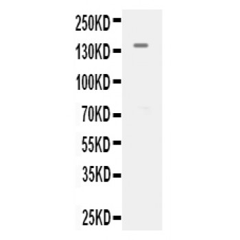 KDR / VEGFR2 / FLK1 Antibody - kDR antibody Western blot. All lanes: Anti kDR at 0.5 ug/ml. WB: MCF-7 Whole Cell Lysate at 40 ug. Predicted band size: 152 kD. Observed band size: 152 kD.