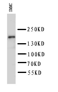 KDR / VEGFR2 / FLK1 Antibody - WB of KDR / VEGFR2 antibody. WB: SMMC Cell Lysate.