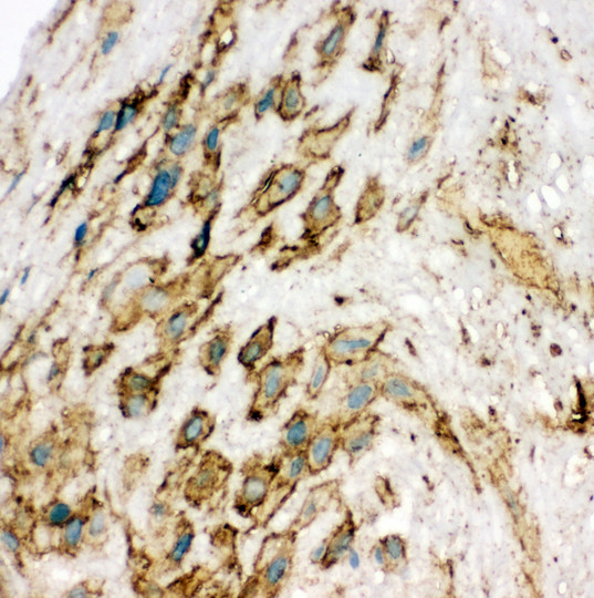 KDR / VEGFR2 / FLK1 Antibody - KDR / VEGFR2 antibody. IHC(F): Human Placenta Tissue.