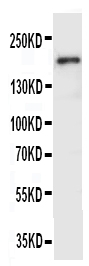 KDR / VEGFR2 / FLK1 Antibody - Anti-VEGF Receptor 2 antibody, Western blottingWB: SMMC Cell Lysate