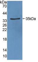 KDR / VEGFR2 / FLK1 Antibody - Western Blot; Sample: Recombinant VEGFR2, Rat.