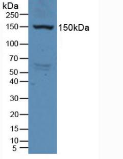KDR / VEGFR2 / FLK1 Antibody - Western Blot; Sample: Rat Serum.