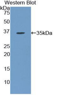 KDR / VEGFR2 / FLK1 Antibody - Western blot of recombinant KDR / VEGFR2.  This image was taken for the unconjugated form of this product. Other forms have not been tested.
