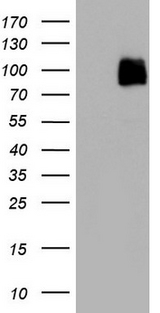 KDR / VEGFR2 / FLK1 Antibody - HEK293T lysate (5ug, left lane) and HEK293T cell lysate expressing human recombinant protein fragment corresponding to amino acids 786-1356 of human KDR (NP_002244).