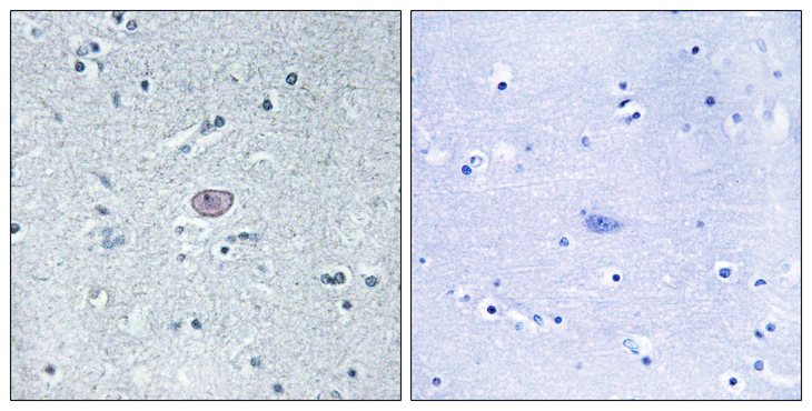 KDR / VEGFR2 / FLK1 Antibody - Immunohistochemistry analysis of paraffin-embedded human brain tissue, using VEGFR2 Antibody. The picture on the right is blocked with the synthesized peptide.
