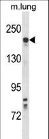 KDR / VEGFR2 / FLK1 Antibody - Mouse Kdr Antibody western blot of mouse lung tissue lysates (35 ug/lane). The Kdr antibody detected the Kdr protein (arrow).