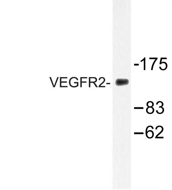 KDR / VEGFR2 / FLK1 Antibody - Western blot of VEGFR2 (D1209) pAb in extracts from 293 cells.