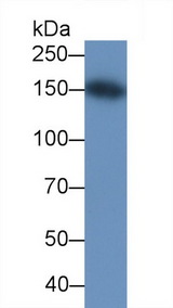 KDR / VEGFR2 / FLK1 Antibody - Western Blot;Sample: Recombinant VEGFR2, Human.