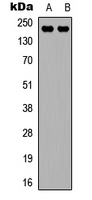 KDR / VEGFR2 / FLK1 Antibody - Western blot analysis of VEGFR2 expression in MCF (A); HepG2 (B) whole cell lysates.
