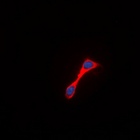 KDR / VEGFR2 / FLK1 Antibody - Immunofluorescent analysis of VEGFR2 staining in MCF7 cells. Formalin-fixed cells were permeabilized with 0.1% Triton X-100 in TBS for 5-10 minutes and blocked with 3% BSA-PBS for 30 minutes at room temperature. Cells were probed with the primary antibody in 3% BSA-PBS and incubated overnight at 4 deg C in a humidified chamber. Cells were washed with PBST and incubated with a DyLight 594-conjugated secondary antibody (red) in PBS at room temperature in the dark. DAPI was used to stain the cell nuclei (blue).