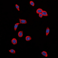KDR / VEGFR2 / FLK1 Antibody - Immunofluorescent analysis of VEGFR2 (pY1214) staining in MCF cells. Formalin-fixed cells were permeabilized with 0.1% Triton X-100 in TBS for 5-10 minutes and blocked with 3% BSA-PBS for 30 minutes at room temperature. Cells were probed with the primary antibody in 3% BSA-PBS and incubated overnight at 4 deg C in a humidified chamber. Cells were washed with PBST and incubated with a DyLight 594-conjugated secondary antibody (red) in PBS at room temperature in the dark. DAPI was used to stain the cell nuclei (blue).