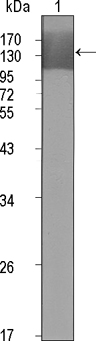 KDR / VEGFR2 / FLK1 Antibody - Western blot using KDR mouse monoclonal antibody against extracellular domain of human KDR (aa20-764).