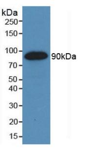 KDR / VEGFR2 / FLK1 Antibody - Western Blot; Sample: Recombinant VEGFR2, Human.