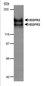 KDR / VEGFR2 / FLK1 Antibody - Detection of VEGFR-2 doublet in CSF-1 receptor/VEGFR2 chimera transfected lysate (20 ug) using VEGFR-2  Antibody (Hemangioblast Marker) (6 ug/ml). ECL detection 30 seconds.  This image was taken for the unconjugated form of this product. Other forms have not been tested.