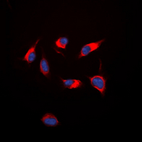 KDR / VEGFR2 / FLK1 Antibody - Immunofluorescent analysis of VEGFR2 staining in HepG2 cells. Formalin-fixed cells were permeabilized with 0.1% Triton X-100 in TBS for 5-10 minutes and blocked with 3% BSA-PBS for 30 minutes at room temperature. Cells were probed with the primary antibody in 3% BSA-PBS and incubated overnight at 4 deg C in a humidified chamber. Cells were washed with PBST and incubated with a DyLight 594-conjugated secondary antibody (red) in PBS at room temperature in the dark. DAPI was used to stain the cell nuclei (blue).