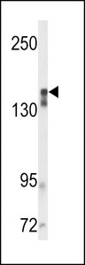 KDR / VEGFR2 / FLK1 Antibody - Western blot of VGFR2 Antibody in mouse cerebellum tissue lysates (35 ug/lane). VGFR2 (arrow) was detected using the purified antibody.