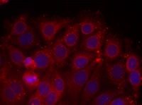 KDR / VEGFR2 / FLK1 Antibody - Immunofluorescent staining using VEGFR2 antibody. Immunofluorescence staining of methanol-fixed MCF cells using VEGFR2 antibody