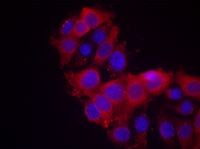 KDR / VEGFR2 / FLK1 Antibody - Immunofluorescent staining using VEGFR2 antibody. Immunofluorescence staining of methanol-fixed MCF cells using VEGFR2 antibody
