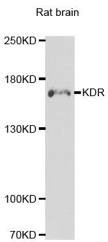 KDR / VEGFR2 / FLK1 Antibody - Western blot analysis of extracts of rat brain cell lines.