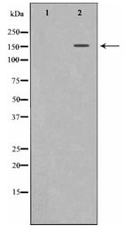 KDR / VEGFR2 / FLK1 Antibody - Western blot of VEGFR2 expression in SK-OV3 whole cell lysates,The lane on the left is treated with the antigen-specific peptide.
