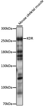 KDR / VEGFR2 / FLK1 Antibody - Western blot analysis of extracts of mouse skeletal muscle, using KDR antibody at 1:1000 dilution. The secondary antibody used was an HRP Goat Anti-Rabbit IgG (H+L) at 1:10000 dilution. Lysates were loaded 25ug per lane and 3% nonfat dry milk in TBST was used for blocking. An ECL Kit was used for detection and the exposure time was 30s.