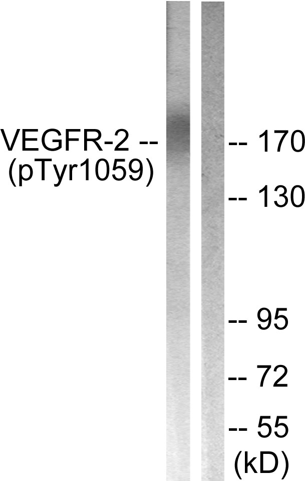 KDR / VEGFR2 / FLK1 Antibody - Western blot analysis of lysates from HepG2 cells treated with Na3VO4 0.3nM 40', using VEGFR2 (Phospho-Tyr1059) Antibody. The lane on the right is blocked with the phospho peptide.
