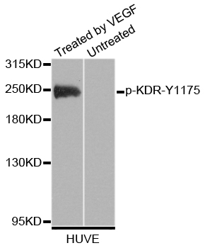 KDR / VEGFR2 / FLK1 Antibody - Western blot analysis of extracts of HUVE cells.