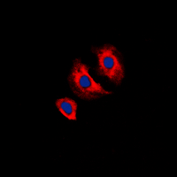 KDR / VEGFR2 / FLK1 Antibody - Immunofluorescent analysis of VEGFR2 (pY1175) staining in MCF7 cells. Formalin-fixed cells were permeabilized with 0.1% Triton X-100 in TBS for 5-10 minutes and blocked with 3% BSA-PBS for 30 minutes at room temperature. Cells were probed with the primary antibody in 3% BSA-PBS and incubated overnight at 4 deg C in a humidified chamber. Cells were washed with PBST and incubated with a DyLight 594-conjugated secondary antibody (red) in PBS at room temperature in the dark. DAPI was used to stain the cell nuclei (blue).
