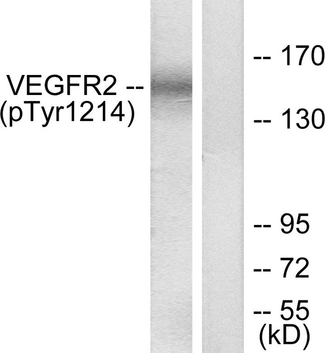 KDR / VEGFR2 / FLK1 Antibody - Western blot analysis of lysates from HepG2 cells treated with Na3VO4 0.3nM 40', using VEGFR2 (Phospho-Tyr1214) Antibody. The lane on the right is blocked with the phospho peptide.