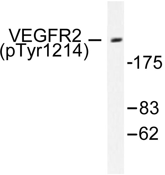 KDR / VEGFR2 / FLK1 Antibody - Western blot of p-Flk-1 (Y1214) pAb in extracts from HepG2 Na3VO4 cells.