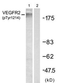 KDR / VEGFR2 / FLK1 Antibody - Western Blot of VEGFR2 antibody. Western Blot analysis of extracts from SKOV3 cells using VEGFR2 (Phospho-Tyr1214) antibody (Lane 1) and the same antibody preincubated with blocking peptide (Lane 2)
