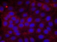 KDR / VEGFR2 / FLK1 Antibody - Immunofluorescent staining using VEGFR2 antibody. Immunofluorescence staining of methanol-fixed MCF cells using VEGFR2 (Phospho-Tyr1214) antibody