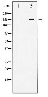 KDR / VEGFR2 / FLK1 Antibody - Western blot of VEGFR2 phosphorylation expression in Na3VO4 treated HepG2 whole cell lysates,The lane on the left is treated with the antigen-specific peptide.