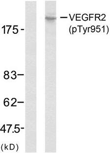 KDR / VEGFR2 / FLK1 Antibody - Western blot analysis of lysates from SK-OV3 cells, using VEGFR2 (Phospho-Tyr951) Antibody. The lane on the left is blocked with the phospho peptide.