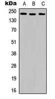 KDR / VEGFR2 / FLK1 Antibody - Western blot analysis of VEGFR2 (pY951) expression in MCF (A); HeLa (B); SKOV3 (C) whole cell lysates.