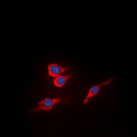 KDR / VEGFR2 / FLK1 Antibody - Immunofluorescent analysis of VEGFR2 (pY951) staining in MCF7 cells. Formalin-fixed cells were permeabilized with 0.1% Triton X-100 in TBS for 5-10 minutes and blocked with 3% BSA-PBS for 30 minutes at room temperature. Cells were probed with the primary antibody in 3% BSA-PBS and incubated overnight at 4 deg C in a humidified chamber. Cells were washed with PBST and incubated with a DyLight 594-conjugated secondary antibody (red) in PBS at room temperature in the dark. DAPI was used to stain the cell nuclei (blue).