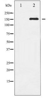 KDR / VEGFR2 / FLK1 Antibody - Western blot of VEGFR2 phosphorylation expression in SK-OV3 whole cell lysates,The lane on the left is treated with the antigen-specific peptide.