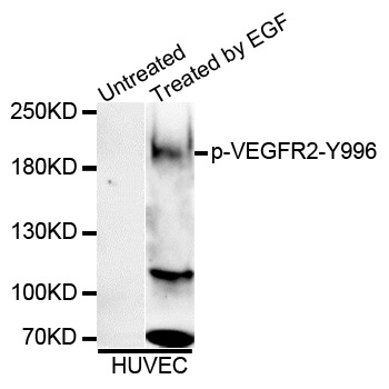 KDR / VEGFR2 / FLK1 Antibody - Western blot analysis of extracts of HUVEC cells.