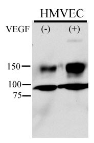 KDR / VEGFR2 / FLK1 Antibody - Anti-Phospho-KDR/FLK1-Y996 antibody is used in Western blot to detect Phospho-KDR/FLK1-Y996 in HMVEC cell line lysate. Endothelial cells were stimulated with 50 ug/ml VEGF for 5min; 20ug lysate from HMVEC was loaded onto an 8% gel; for Western blot, membranes were incubated O/N with Phospho-KDR/FLK1-Y996 Antibody diluted to 1:500 in 1% Milk/TBST. Data and Protocol kindly provided by Dr. Weis from Cheresh Lab, UCSD.