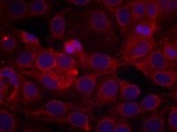 KDR / VEGFR2 / FLK1 Antibody - Immunofluorescent staining using VEGFR2 antibody. Immunofluorescence staining of methanol-fixed MCF cells using VEGFR2 (Phospho-Tyr1175) antibody