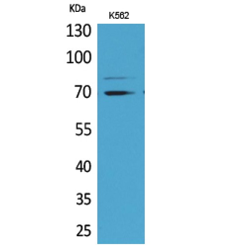 KEAP1 Antibody - Western blot of Keap1 antibody