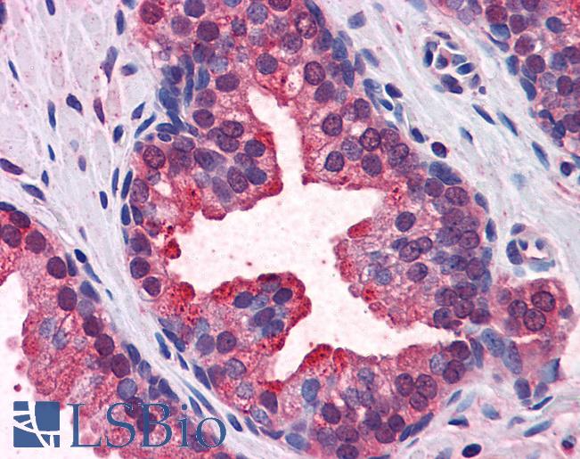 KEAP1 Antibody - Anti-KEAP1 antibody IHC of human prostate. Immunohistochemistry of formalin-fixed, paraffin-embedded tissue after heat-induced antigen retrieval. Antibody concentration 5 ug/ml.  This image was taken for the unconjugated form of this product. Other forms have not been tested.