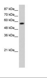 KEAP1 Antibody - Transfected Cell Lysate.  This image was taken for the unconjugated form of this product. Other forms have not been tested.