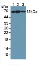 KEAP1 Antibody - Western Blot; Sample: Lane1: Human 293T Cells; Lane2: Human HepG2 Cells; Lane3: Human Placenta Tissue.