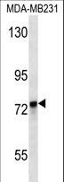 KEAP1 Antibody - KEAP1 Antibody western blot of MDA-MB231 cell line lysates (35 ug/lane). The KEAP1 antibody detected the KEAP1 protein (arrow).