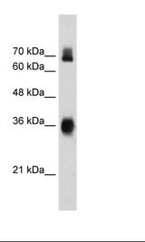 KEAP1 Antibody - HepG2 Cell Lysate.  This image was taken for the unconjugated form of this product. Other forms have not been tested.