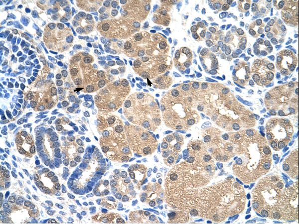 KEAP1 Antibody - KEAP1 antibody ARP34728_T100-NP_987096-KEAP1(kelch-like ECH-associated protein 1) Antibody was used in IHC to stain formalin-fixed, paraffin-embedded human kidney.  This image was taken for the unconjugated form of this product. Other forms have not been tested.