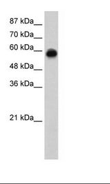 KEAP1 Antibody - Transfected Cell Lysate.  This image was taken for the unconjugated form of this product. Other forms have not been tested.
